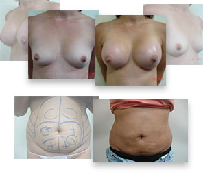 Before and After Cases